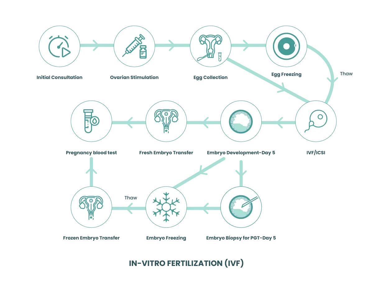 IVF Diagram